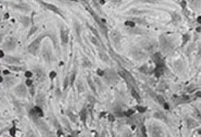 Magnified skin surface after, finer texture